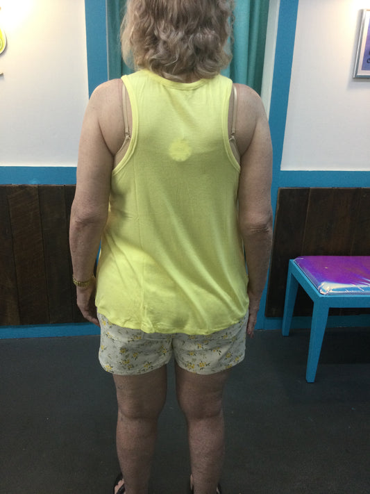 Solid ribbed tank